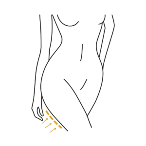 Woman's body illustration highlighting the location of the Thighplasty surgery